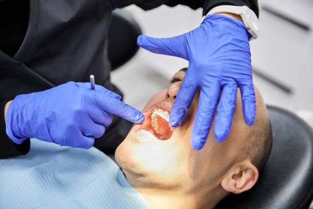 Best Broken Tooth Emergency  in Marysville, KS