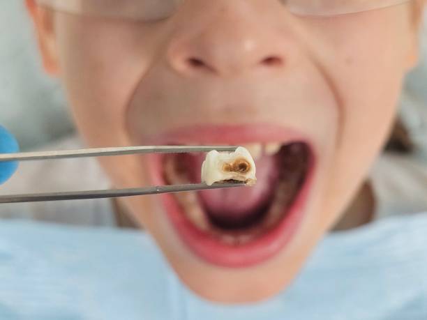 Best Emergency Tooth Extraction  in Marysville, KS